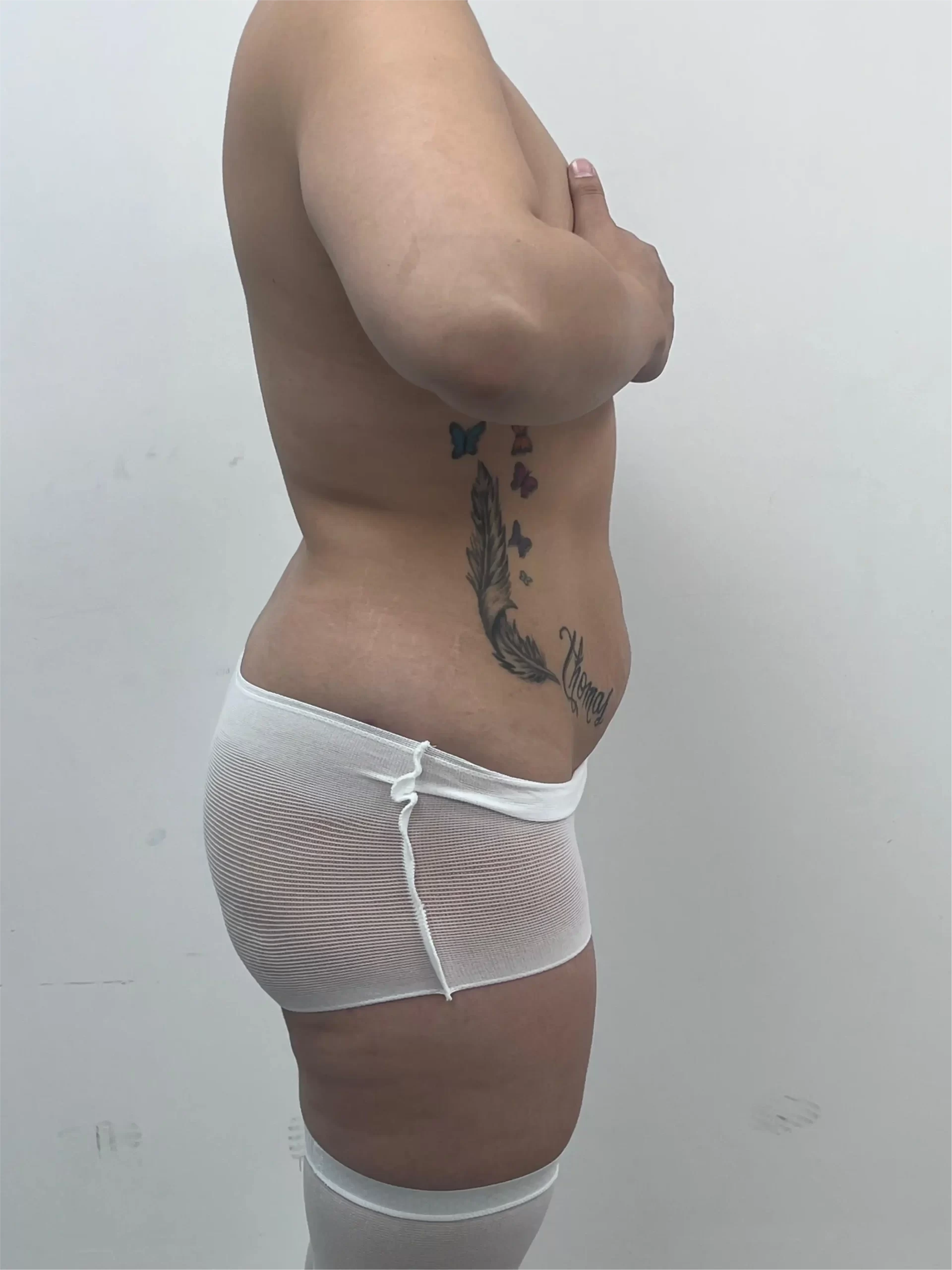 Antes Antes